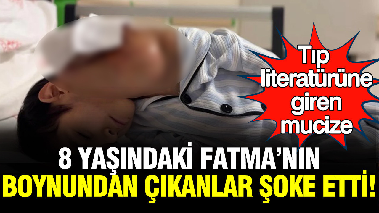 dunya-bu-mucize-vakayi-konusuyor-eskisehirde-8-yasindaki-fatmanin-cikan-kitle-tip-tarihini-degistirdi-jLUB7rlX